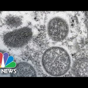 WHO Declares Monkeypox A Global Health Emergency As Cases Skyrocket