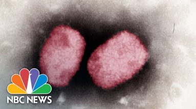 New York Man Details Experience With Monkeypox